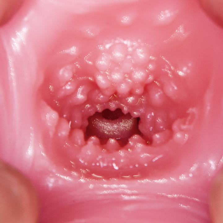 Extreme Pleasure Hip Third Generation